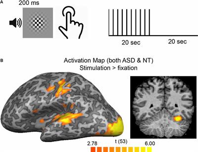 Late fMRI Response Components Are Altered in Autism Spectrum Disorder